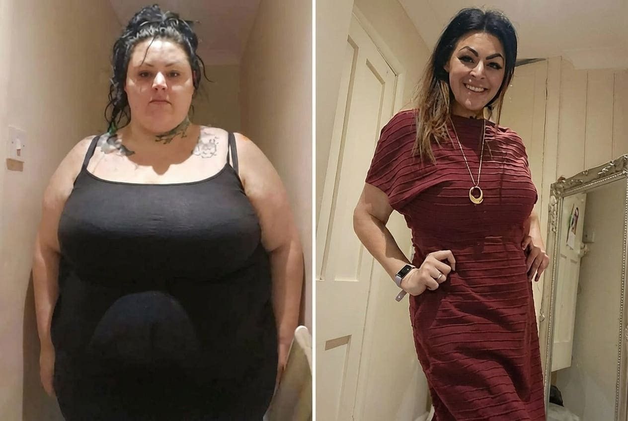 Antes y después de usuario 1